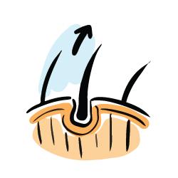 Hair Removal